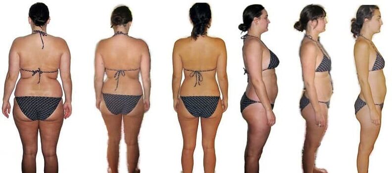 Before and after losing weight