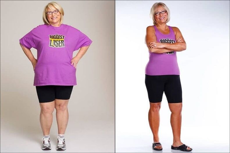 Woman before and after losing weight